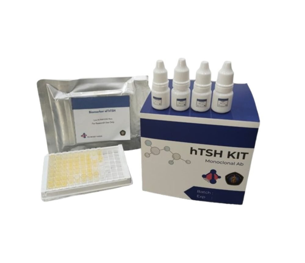 Inovasi Deteksi Dini Hipotiroid Kongenital UB Masuk 117 Inovasi Indonesia 2025